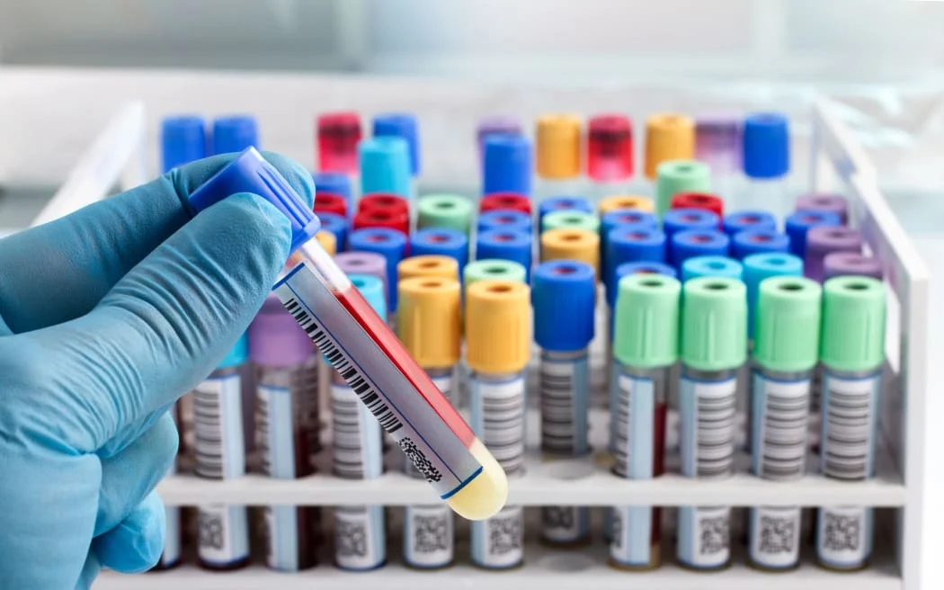 Plans to move tissue testing to Christchurch dropped