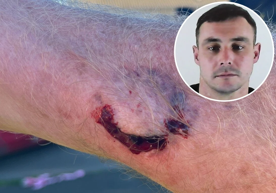 Drink driver jailed for biting pensioner after Richmond crash