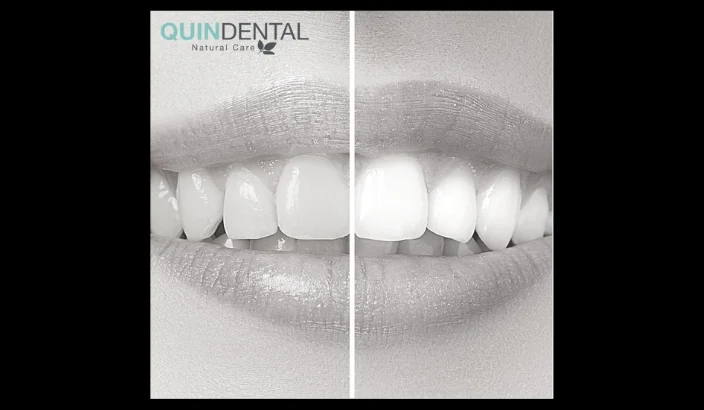 Quin Dental - Thumbnail 2