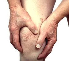 The impact of arthritis