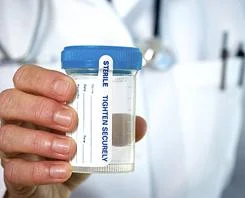 Drug test failures surprise